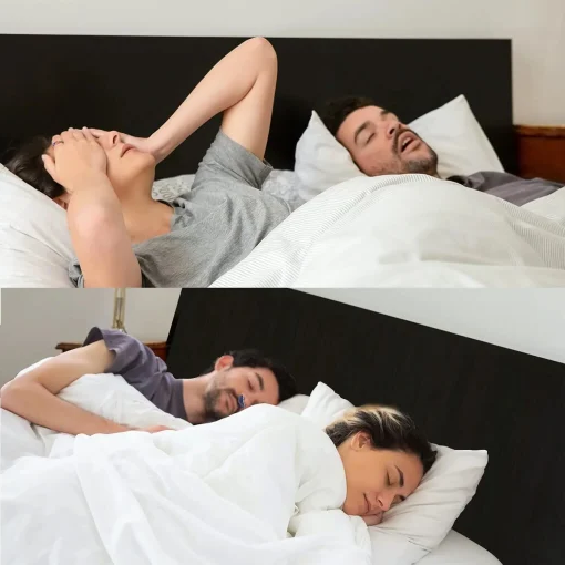 Micro CPAP Sleep Apnea Machine – Portable Anti-Snoring Device for Travel 1