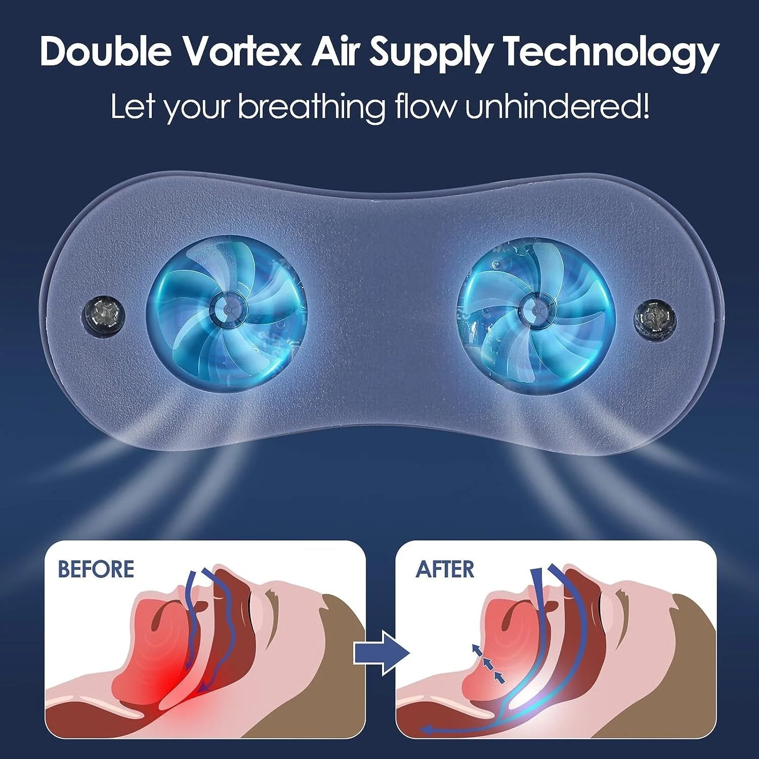 Micro CPAP Sleep Apnea Machine – Portable Anti-Snoring Device for Travel 5