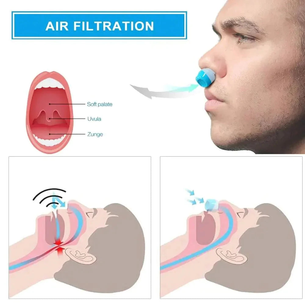Micro CPAP Sleep Apnea Machine – Portable Anti-Snoring Device for Travel 7