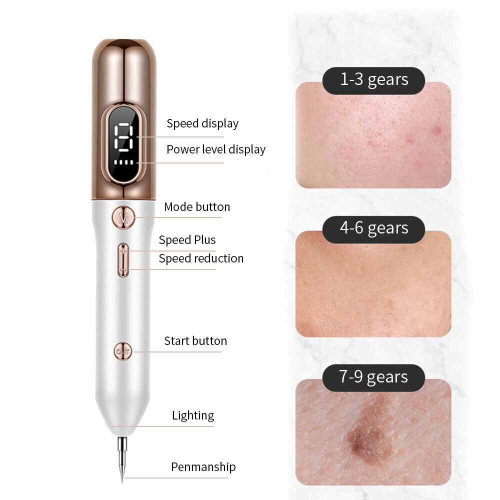 Plasma Pen for Skin Tag and Mole Removal – 9 Intensity Levels, Safe and Easy to Use 4