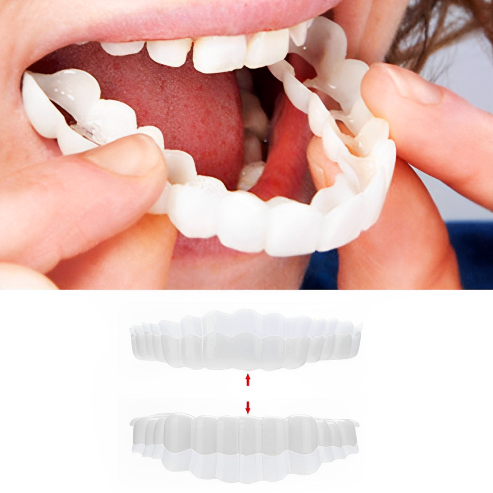 Smile Veneer Set for Upper and Lower Teeth – Instant Smile Transformation with Custom Fit 0