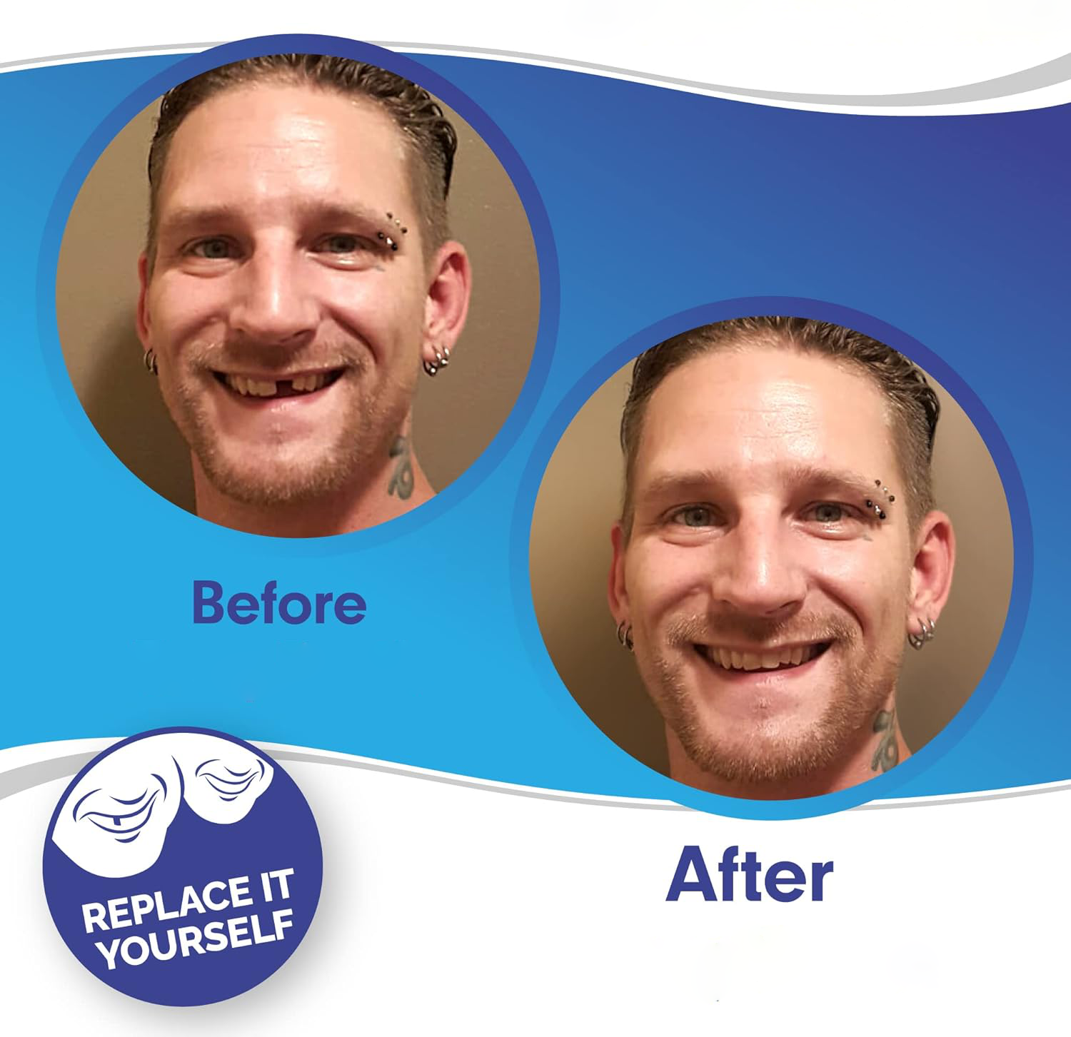 Smile Veneer Set for Upper and Lower Teeth – Instant Smile Transformation with Custom Fit 1