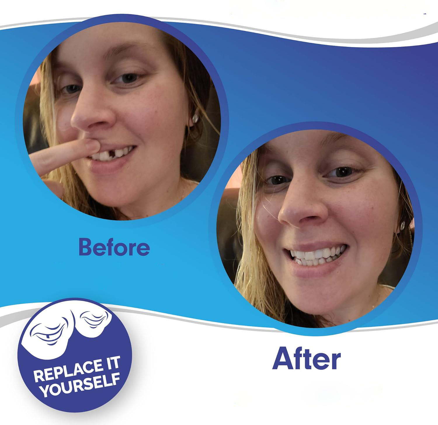 Smile Veneer Set for Upper and Lower Teeth – Instant Smile Transformation with Custom Fit 2